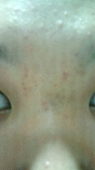 田舎 実業家 従事した 眉間 ニキビ 跡 Biography Jp