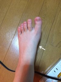 足の甲の内側が痛い 画像の所 足の甲の内側の一点が微妙に腫れていて押せば Yahoo 知恵袋