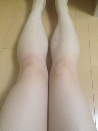 閲覧注意 足の脂肪 女です 足が本当に太いです 太もも54 Yahoo 知恵袋