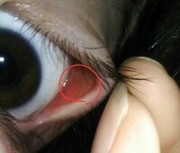 する ゴロゴロ 目 片目 だけ が 目の表面が痛い！チクチク?ゴロゴロ?原因と対処法