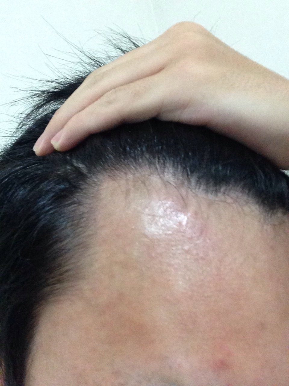 おかしいです 前髪 薄い 高校生