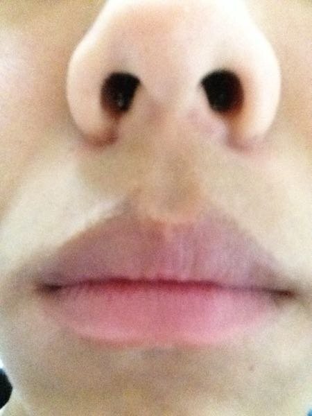 上唇の上の色素沈着治りませんか それと 一日中リップをつけていない Yahoo 知恵袋