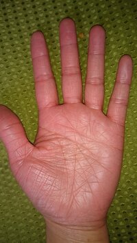手がすごいしわしわなのですが これって手相とかどうなんでしょ Yahoo 知恵袋
