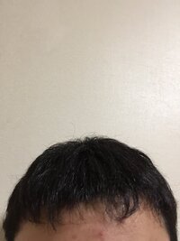 前髪が伸びなくてこまってます 高３です ずっと前髪が伸びないのですがど Yahoo 知恵袋