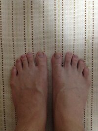 足の形には３種類ありますが 日本人に多いのはエジプト型とギリシャ型どっちです Yahoo 知恵袋
