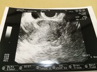 エコー写真双子についてこんばんは 先日4w4dに胎嚢確認 ホッ Yahoo 知恵袋