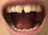 すきっ歯 はかわいいですか Yahoo 知恵袋