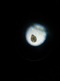 メダカの水槽にいた泳ぐ黒い点々について 顕微鏡で見てみたのです Yahoo 知恵袋