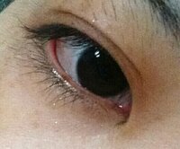 注意 目の写真つき みなさんは目頭まで睫毛が生えてますか 私 Yahoo 知恵袋