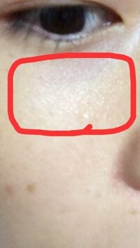 目の下が 毛穴というより凸のようになっています またそこがクマのように黒く見え Yahoo 知恵袋