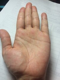 現在妊娠中です 手相を載せました 何かわかればよろしくお願い Yahoo 知恵袋