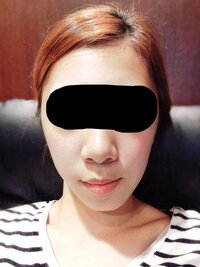 顔の輪郭がこんな感じで 顎関節症を引き起こしてる方の顔が大きくなっ Yahoo 知恵袋