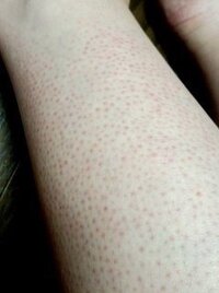 彼と一緒に寝る時、寝る前の保湿クリームなど、顔にベタベタつけられ... - Yahoo!知恵袋