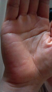 手相に詳しい方 教えてください この手相は 二重生命線ですか それとも知 Yahoo 知恵袋