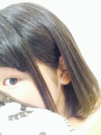 アルビノの人間って寿命が短いとかありますか そんなのないでしょうか ご存知の方 Yahoo 知恵袋