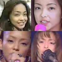安室奈美恵さんは 整形しましたか 工 昔 Yahoo 知恵袋
