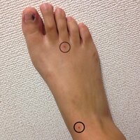 最近 足の甲にいきなりホクロのようなものができました親指の爪も Yahoo 知恵袋