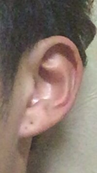 どなたか耳占いお願い致します 貧乏耳で将来心配です泣助言お願いしま Yahoo 知恵袋