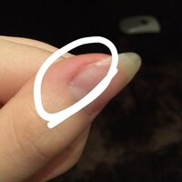 私は 爪の端のささくれを引っこ抜く事に快感を覚えます 真剣な悩みです Yahoo 知恵袋