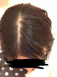 画像 中学生です 正直これって髪の毛薄いですよね 育毛剤など Yahoo 知恵袋