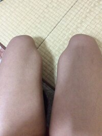 こんにちは 中1女子です 私は太ももが太すぎです せいざをすると写真のよ Yahoo 知恵袋