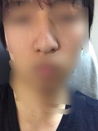 画像有り 鼻を小さくする方法を教えて下さい 私は鼻が大きく外国の血が入っ Yahoo 知恵袋