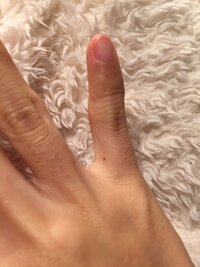 ホクロ占いについて 右手の小指 水掻き の部分に最近ホクロが Yahoo 知恵袋