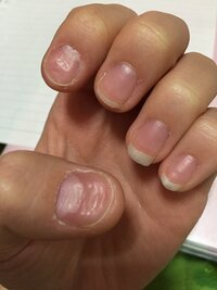 ネイリストの方に質問です ネイルチップでもいいのですがこの爪で Yahoo 知恵袋