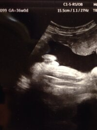 赤ちゃんのエコー写真から性別の判断をお願いします 今までずっと Yahoo 知恵袋