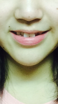 表情筋を鍛えてたら筋肉痛になりました 効いてる証拠ですか Yahoo 知恵袋