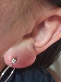 ファーストピアス膿 5日ほど前に始めてピアスを開けました Yahoo 知恵袋