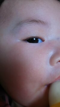 赤ちゃんの瞼についてです 目を開けると一重ですが瞼の内側に線があ Yahoo 知恵袋