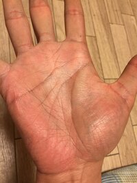 爪がこのようになってしまったのですがどうすれば良いですか 剥がれそう Yahoo 知恵袋