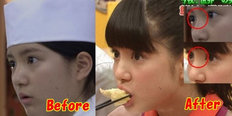川島海荷は整形してるよね 変わってますね パンプ部分の骨 Yahoo 知恵袋