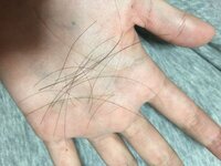 一ヶ月半ぐらい前から抜け毛がひどいです シャンプー時や朝起きたときの枕 Yahoo Beauty