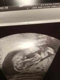 エコー写真で性別どちらか分かりますか 妊娠6ヶ月で超音波検索で股まを閉じ Yahoo 知恵袋