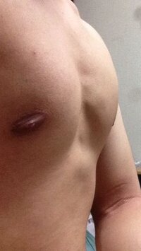 胸板が厚いねっていわれますが胸筋はあるほうですか 横からじゃないので分か Yahoo 知恵袋