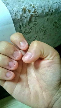 ネイリストさんネイルサロンで働いてる方お願いします 爪噛み癖の方で Yahoo 知恵袋