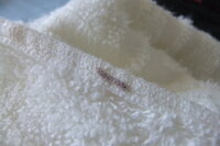 これはなんの卵ですか 干した後の服についてました 硬くてすごく Yahoo 知恵袋