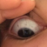 高校二年生です 最近気がついたんですけど 白目に黒い点 のようなものが４ Yahoo 知恵袋