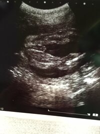 胎児の性別って妊娠何週目くらいでわかりましたか 実際産まれて違 Yahoo 知恵袋