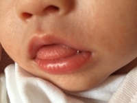 舌を出して寝る子 私の6ヶ月になる息子は 寝ている時に舌を出 Yahoo 知恵袋