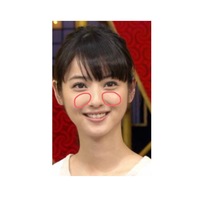 画像の方のように 頬骨から上 目の下にかけての肉だけ何故か多く Yahoo 知恵袋