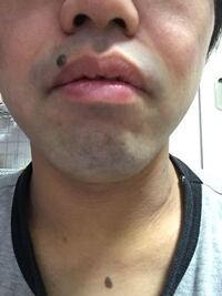 女子高生です 青ひげに悩んでいます 鼻の下の産毛をカミ Yahoo 知恵袋