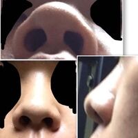 Psvitaのマインクラフトに コマンドブロック は追加できるの Yahoo 知恵袋