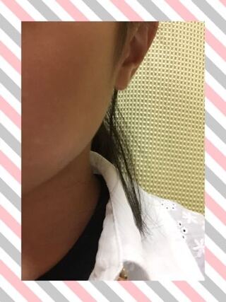 中学生女子におすすめの洗顔を教えて下さい 肌質は写真の通りです Yahoo 知恵袋