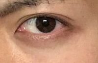 目の下の黒ずみ についてなんですがこれはクマというやつですか Yahoo 知恵袋