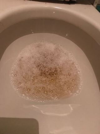 尿が気になっています 一年半 位前から稀に尿が泡立ちます 5分くら Yahoo 知恵袋