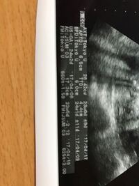 妊娠25週6日の妊婦です 前回の検診から胎児が小さめと言われ 今日 Yahoo 知恵袋