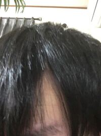 よくモデルさんとかでニキビが出来ないように前髪をあげて寝ると Yahoo 知恵袋